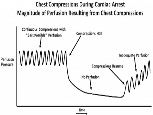 pauses in compression typically occur