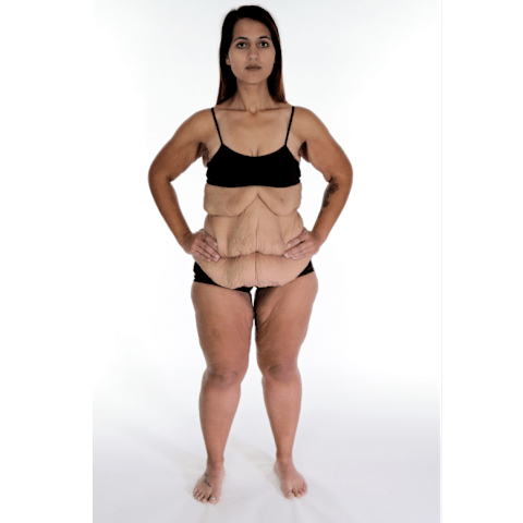 Las 5 Transformaciones Mas Increibles De Mi Vida Con 300 Kilos