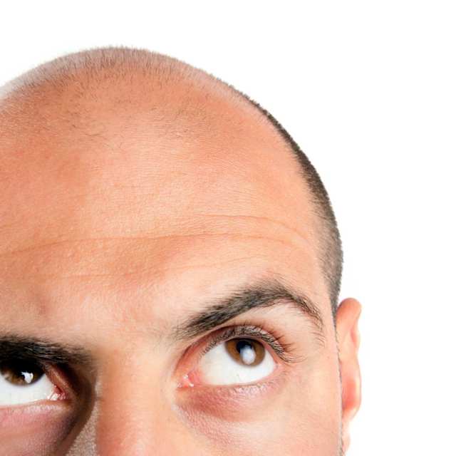 No hair