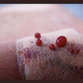 Blood