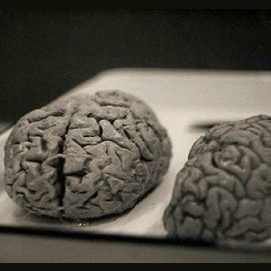 Brains 