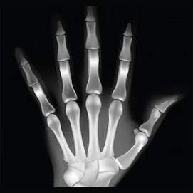 X-ray Vision 