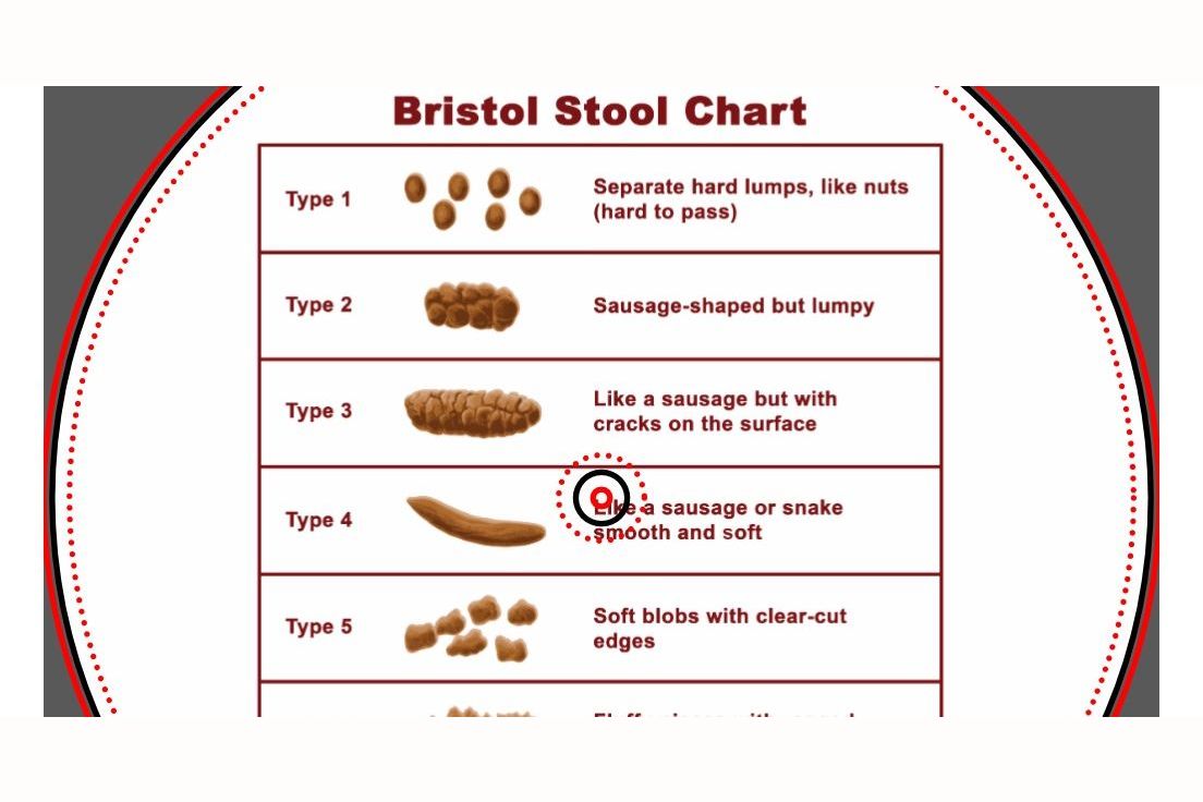 What Is Your Fecal Personality Type?