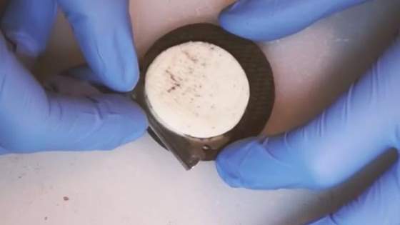 They even used surgeon grade tools and everything.