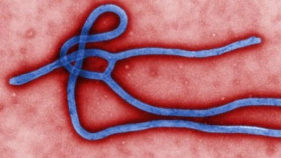 A plague that wipes out 25 million people in three years. A disease that kills its victims within hours of the symptoms appearing. A flu that makes its sufferers turn blue before drowning in their own lungs.

It sounds like the stuff of science-fiction movies, but for centuries, these horrid diseases were very real (in fact, some of them could still pose a threat today). What are they? Read on as we uncover the seven deadliest diseases in history.