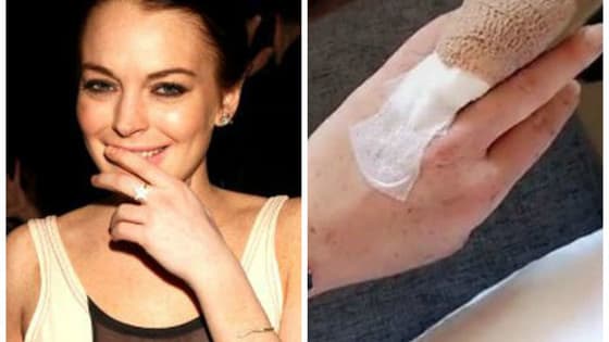 Lindsay Lohan lost half a finger in a boating accident this weekend, but fortunately was able to reattach it. What would you do in her situation?