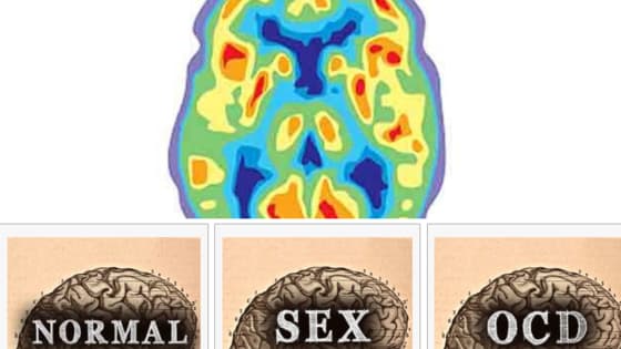 Only a brain surgeon can decipher neuroimaging and its color patterns - Or can you, too? Are you as smart as a brain surgeon?
