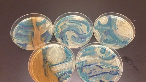 In the Agar Art Challenge, scientists were challenged to paint using bacteria. They grew microbes in petri dishes and the results were amazing! 