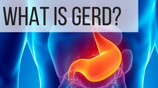 Acid reflux, conjointly known as pyrosis, is caused by acidic biological process juices locomotion up from the abdomen and getting into back to the gullet. It's associated with reflux illness (or GERD), the additional severe sort of these issues.