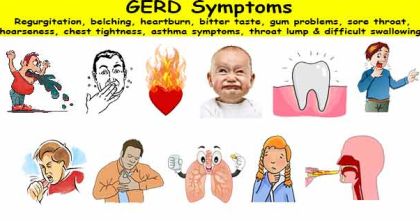 What are the common Gerd Symptoms