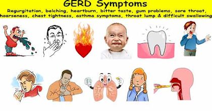 What are the common Gerd Symptoms