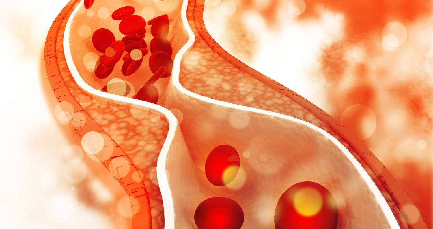 does-eating-less-cholesterol-actually-lower-it