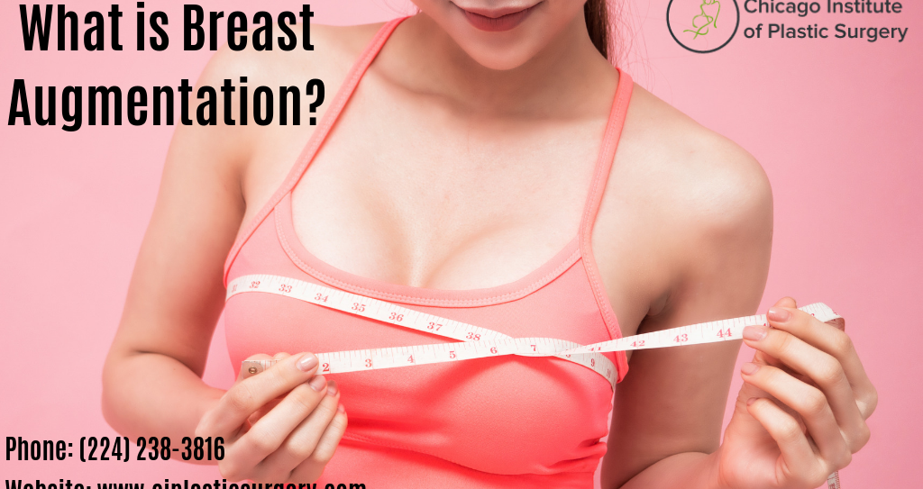 What Is Breast Line