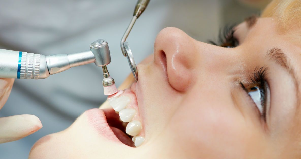 Why professional dental cleaning is necessary?
