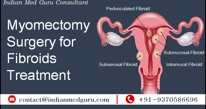 post-myomectomy-lower-abdominal-pain-causes-and-management-medshun