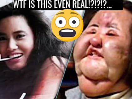 Why You Shouldn T Get Plastic Surgery Dun Dun Dun