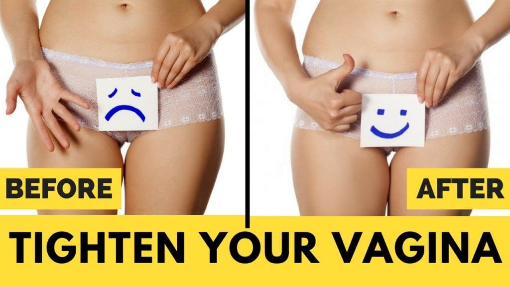 how to tighten your vag with surgery