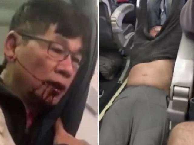 The man was injured being removed from a flight in Chicago