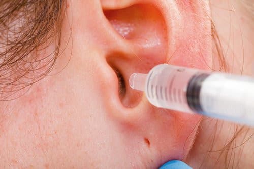 Limpiar tus oídos con hisopos es peligroso. Conoce cómo mantener la higiene del oído