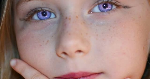 No hay evidencia médica que indique que este color en los ojos altere la capacidad visual de las personas.  