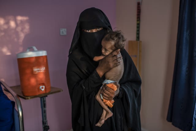 Ante tres años en guerra, Yemen importa alrededor de 90% de los productos que consume. Los alimentos quedan retenidos en el puerto Al Hudaydah, controlado por Arabia Saudita. Al menos 85.000 niños menores de cinco años han muerto de hambre desde que empezó la guerra y la OMS estima que siete millones están en hambruna. Los yemeníes no tienen suministro de agua potable y el bloqueo impide la llegada de combustible, y por consiguiente, que se trasladen camiones cisternas. La epidemia de cólera ha sido una de las consecuencias de la falta de agua potable; Yemen cuenta más de un millón de casos de cólera durante la guerra, constituyendo el peor brote del que se tenga registro.