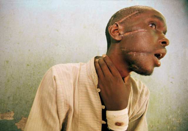 Un hombre tutsi vÃctima de un ataque por parte de los hutu